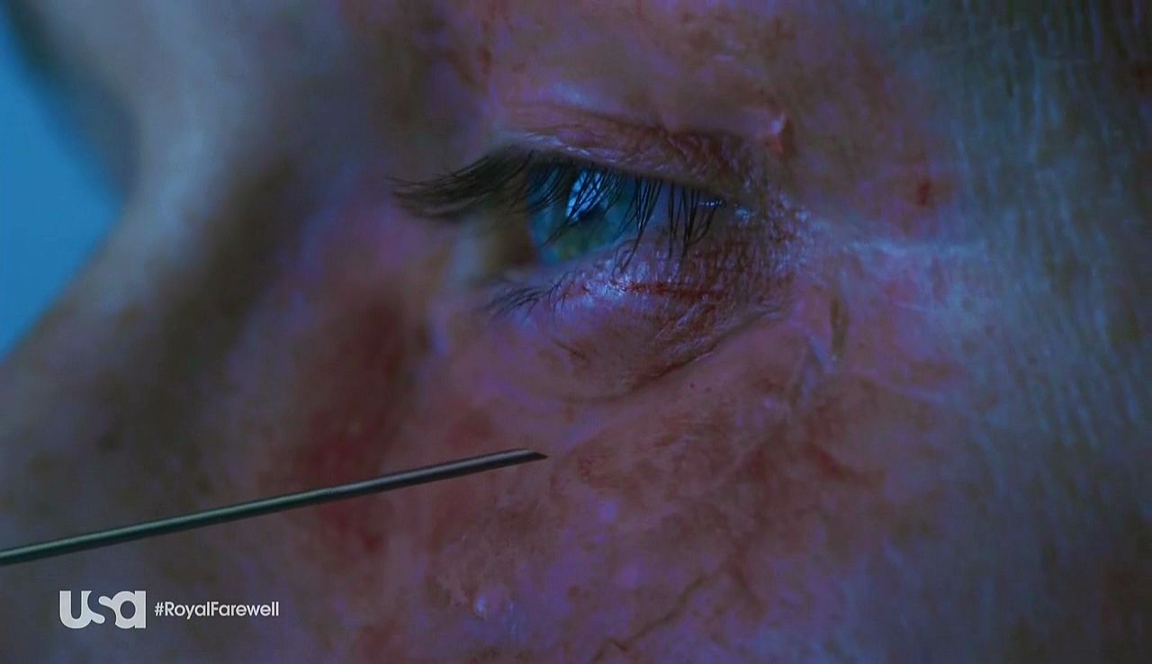 Royal Pains S8E4 Doubt of Africa