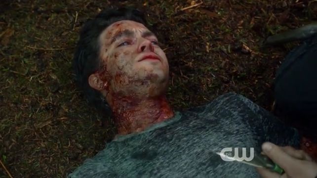 The 100 S1E3 Earth Kills