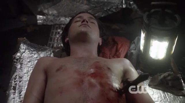 The 100 S1E7 Contents Under Pressure
